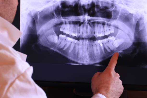 Best Emergency Dental Surgery in Rose Hill, KS