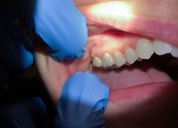 Best Urgent Dental Care in Rose Hill, KS