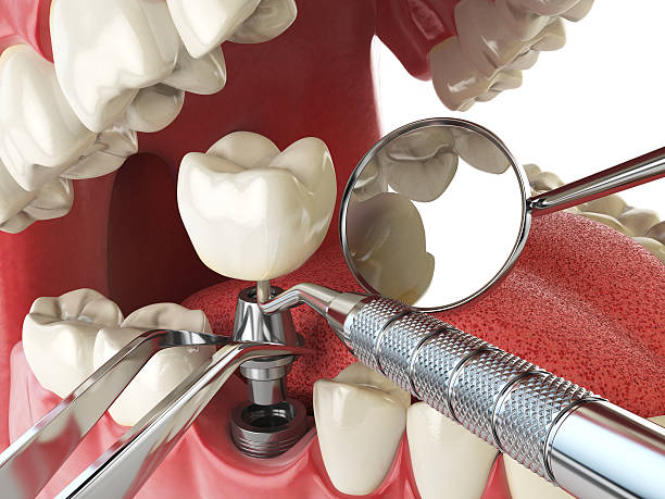 Best Emergency Treatment for Toothache in Rose Hill, KS