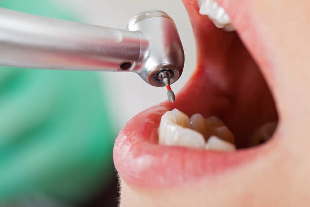 Best Emergency Dental Care for Trauma or Injury in Rose Hill, KS